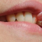 抜歯の全身麻酔と術後の痛み